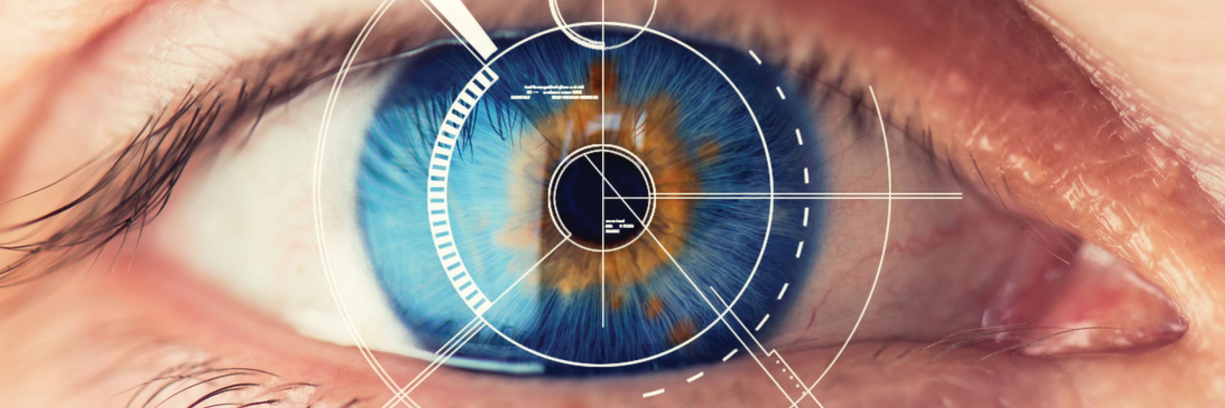 Тест сетчатки глаза. Сетчатка глаза биометрия. Сканер по радужной оболочке глаза. Коррекция зрения лазером.